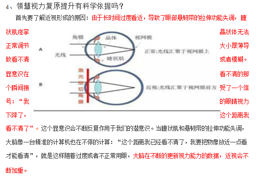 最新視力矯正技術(shù)介紹與突破