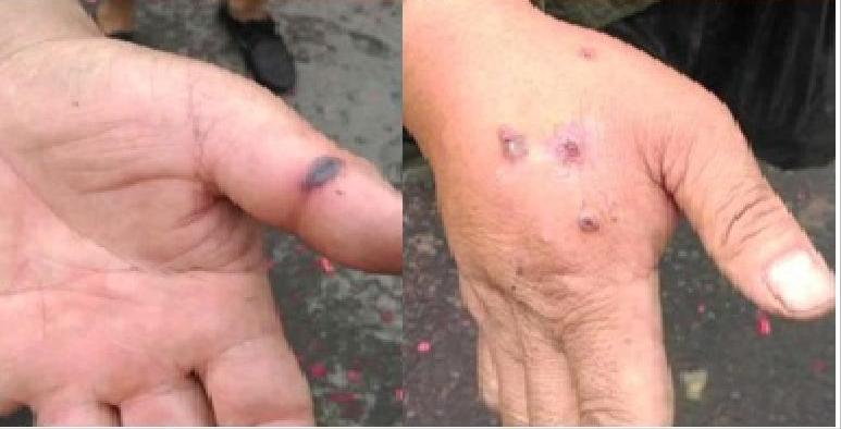 北京最新疫情動(dòng)態(tài)與巷弄深處的獨(dú)特風(fēng)味