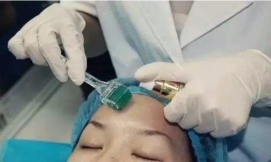 果酸換膚成本與代價揭秘，美麗背后的價格標簽