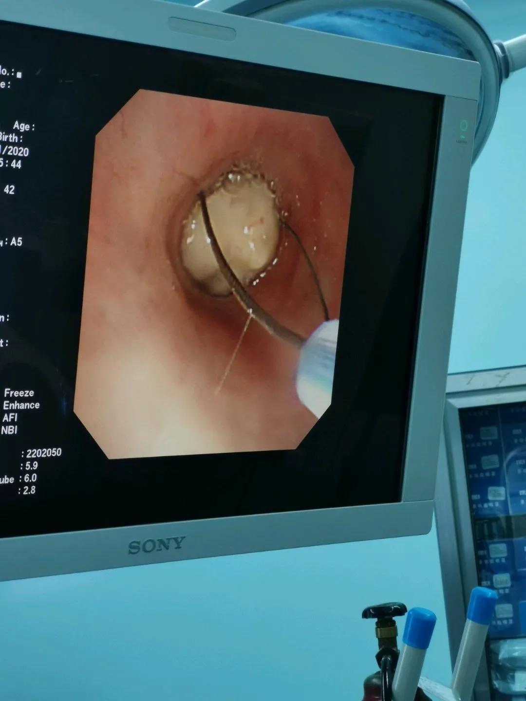 電子鼻咽喉鏡價格的市場定位分析，多元因素下的市場趨勢探討