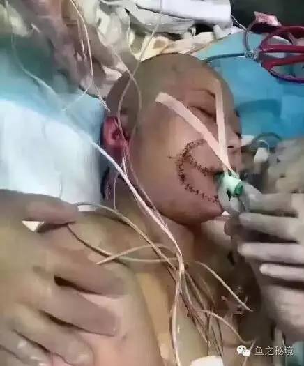 被虎咬的女子的最新消息，日常中的奇遇時刻